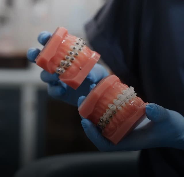 Ортодонтия